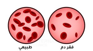 فقر الدم..كيف تحوله من عدو إلى صديق