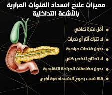 دور الطبيب في علاج التهاب القناة المرارية وأهمية المتابعة الدورية