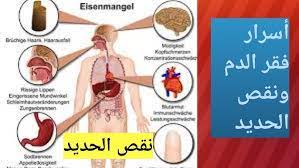  أسرارٌ مخفيةٌ... أعراضٌ تدلّ على فقر الدم وأنوعه وطرق اكتشافه