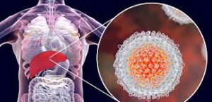  ما هو التهاب الكبد الوبائي أعراضه وأسبابه وكيفية تجنبه ..حقائق علمية 